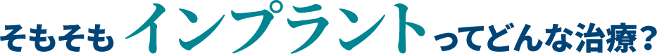 そもそもインプラントってどんな治療？